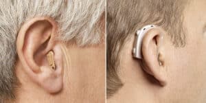 Audifonos Para Sordos